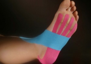 Kinesiotaping